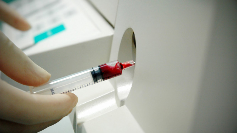 Cardiac Biomarker Diagnostic Kits Market Enhancement and Its growth prospects forecast 2022 to 2025 |Research Informatic
