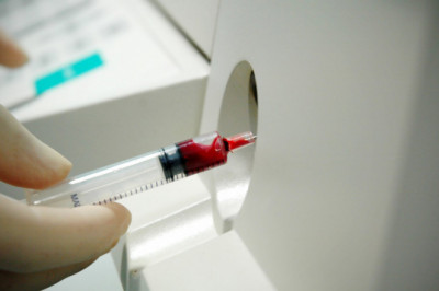 Cardiac Biomarker Diagnostic Kits Market Enhancement and Its growth prospects forecast 2022 to 2025 |Research Informatic