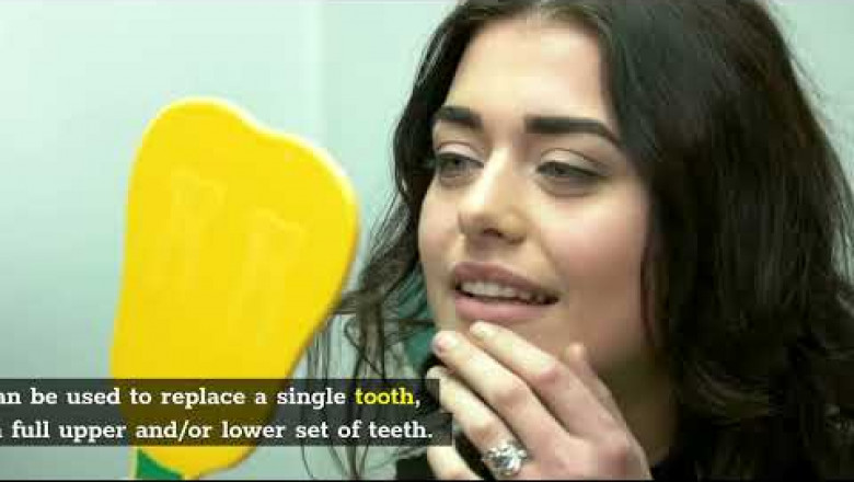 Dental Implants Sherman Oaks