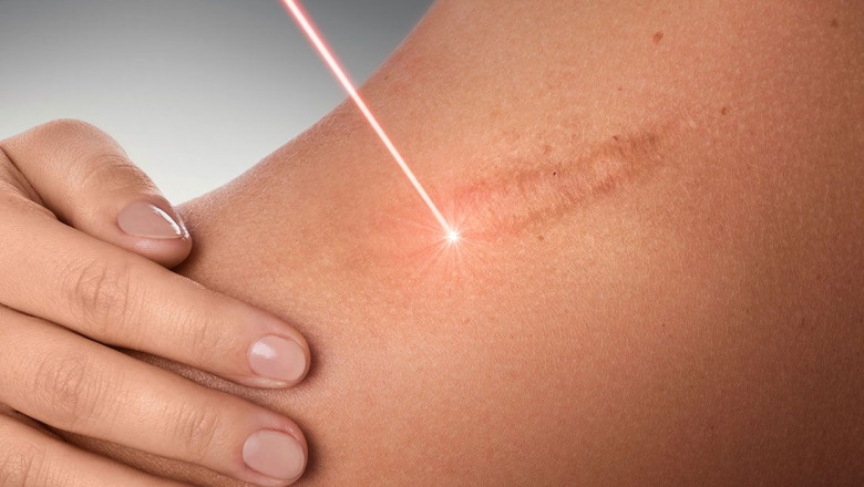 The Most Effective Dermatologist Treatments for your Skin