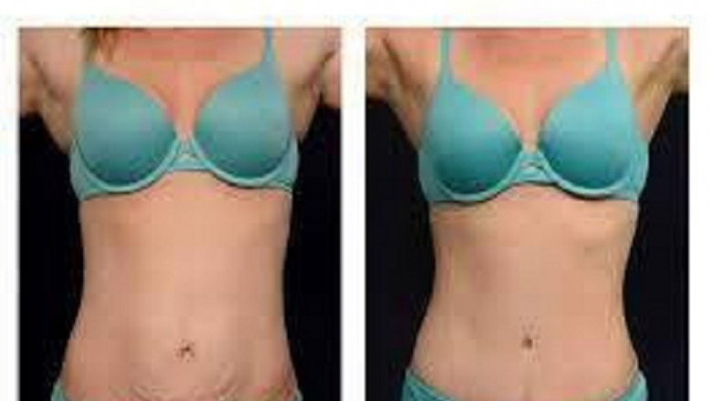 How Painful is a Breast Lift?