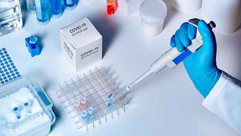 Can an RT-PCR test is a trusted and effective diagnostic tool?