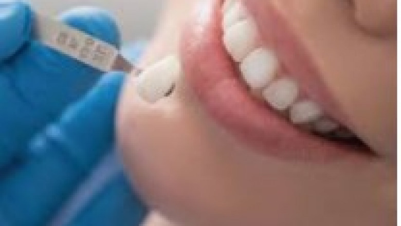 Precisely just how To Select A Dentist