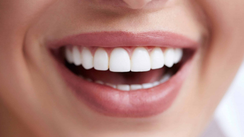 What Are The Different Types Of Dentures?