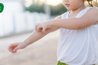 Summer Skin Care Tips for Babies