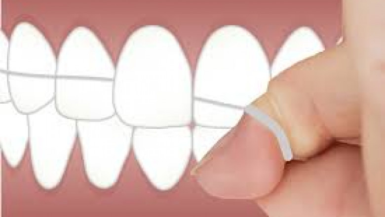 How To Treat A Tooth Abscess?