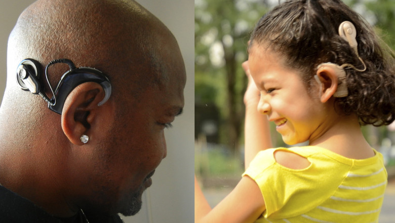 Cochlear Implants Market Growth Statistics,Size, SWOT Analysis, Forthcoming Developments, Upcoming Investments and Forecast 2019 - 2027