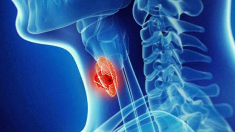 Global Hodgkin’s Lymphoma Treatment Market Drivers