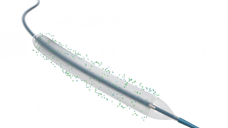 Treatment of Obstructed Vessels Using the PTA balloon catheter
