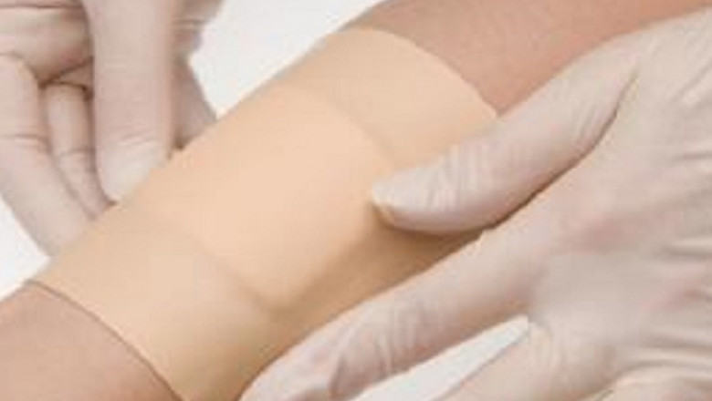 Advanced Wound Care Market – Global Industry Trends & Forecast to 2028