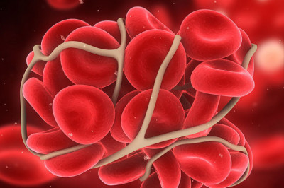 Anticoagulant reversal Drugs Market Information, Figures, and Analytical Insights 2021– 2028
