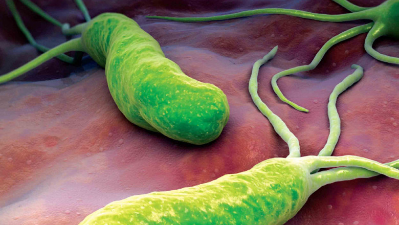 Helicobacter Pylori Diagnostics Market size, key developments, and competitive information 2022-2028| Research Informatic