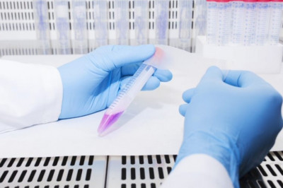 Pharmaceutical Processing Seals Market Size Estimation Research Report, 2022-2030