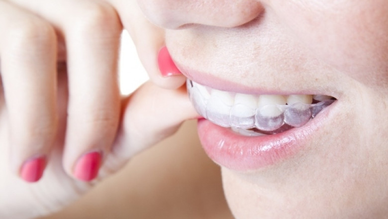 Attain Increased Source Of Information With Fixed Retainer