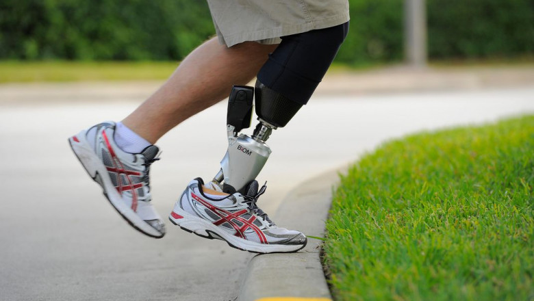 Prosthetic legs are the lightweight artificial limbs developed for people with leg amputations that can last for four years