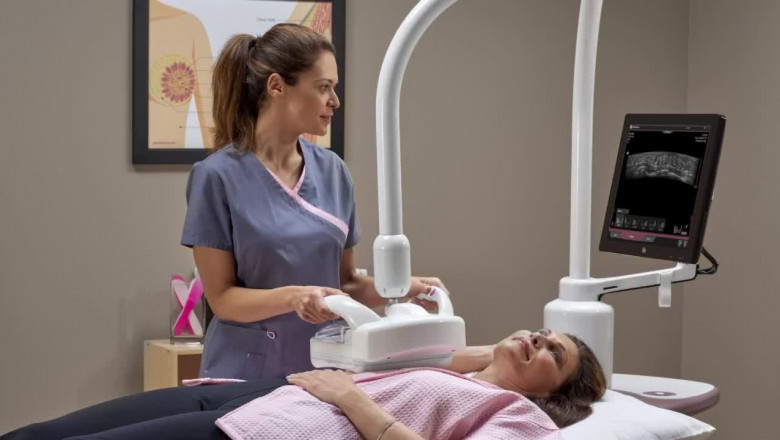 What are the growth estimates for Automated Breast Ultrasound Systems (ABUS) Market till 2027?