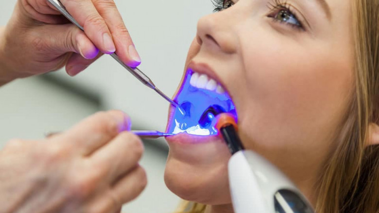 Why Should You Visit Dentists For Regular Checkups?