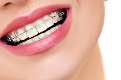 What are the treatments provided by the best Bensonhurst Orthodontist?