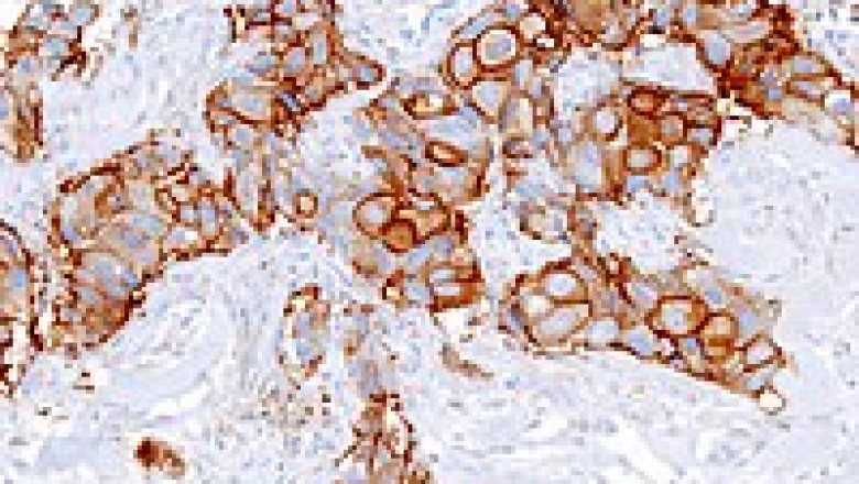 Anatomic Pathology Market Share, Growth, Statistics, by Application, Production, Revenue &amp; Forecast