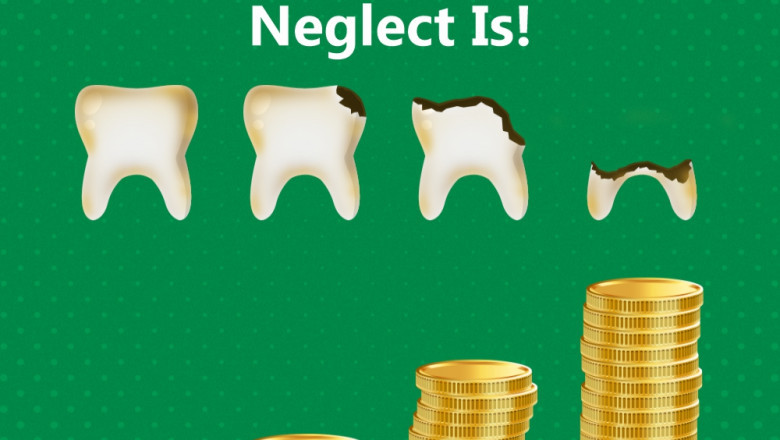 Best Dental Clinic for Root Canal Treatment in HSR Layout, Bangalore