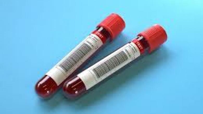 Blood Testing Market Size, Development, Key Opportunity, Application & Forecast