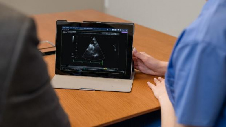 ECG Management Systems Market Size, Share, Trends, Business development, Analysis And Opportunities 2018-2026