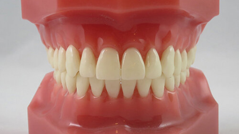 What Are The Signs Indicate An Underbite