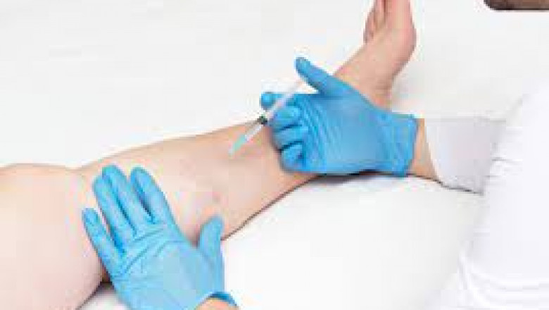 When Should You Visit A Vein Clinic?