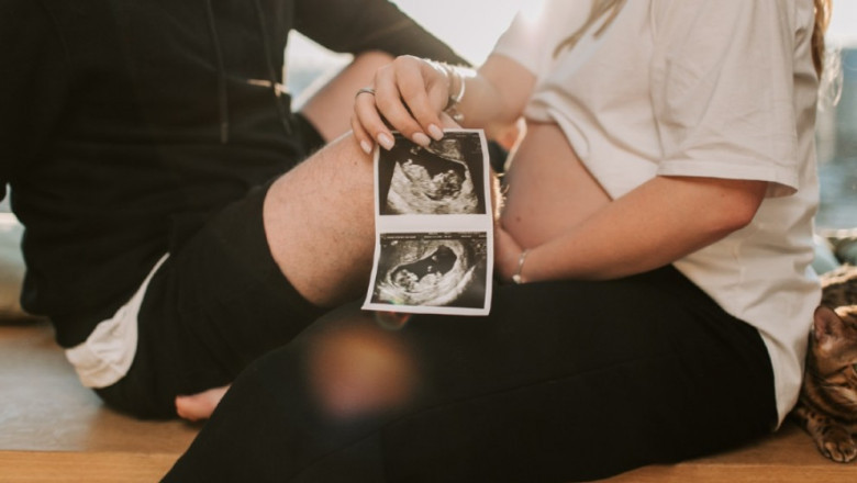 Use of Color Doppler Ultrasound During Pregnancy
