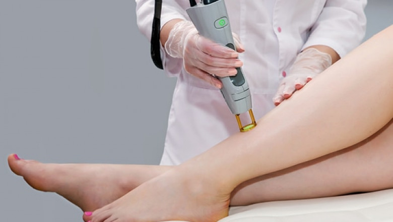 5 Things about Laser Hair Removal Nobody Told You Before