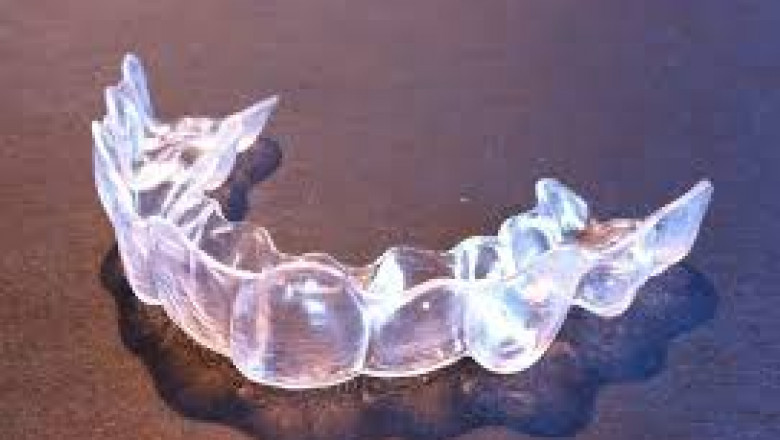 How to Deal with Invisalign Pain and Discomfort | Tower House Dental Clinic