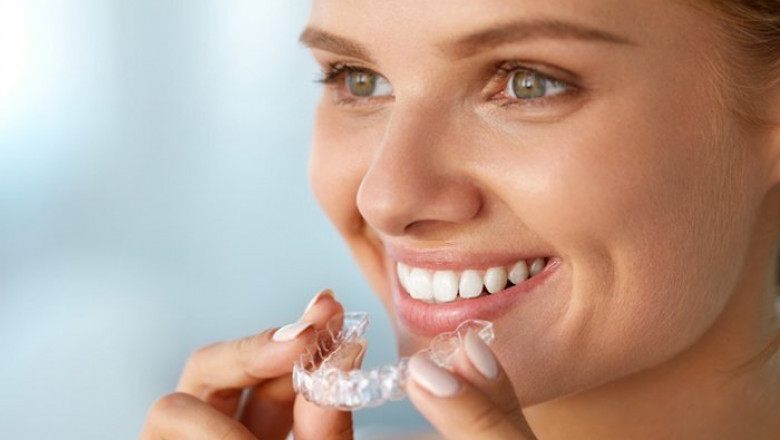 The Important of Regular Dental Checkup