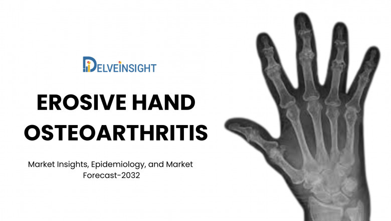 What is the Erosive Hand Osteoarthritis Market Forecast?
