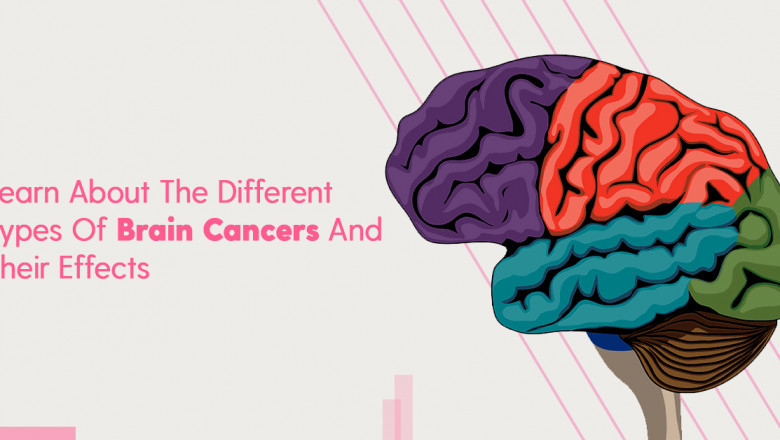 Different Types Of Brain Cancers, Effects &amp; Treatments