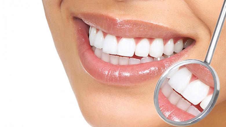 Which product is mostly used in teeth whitening products?