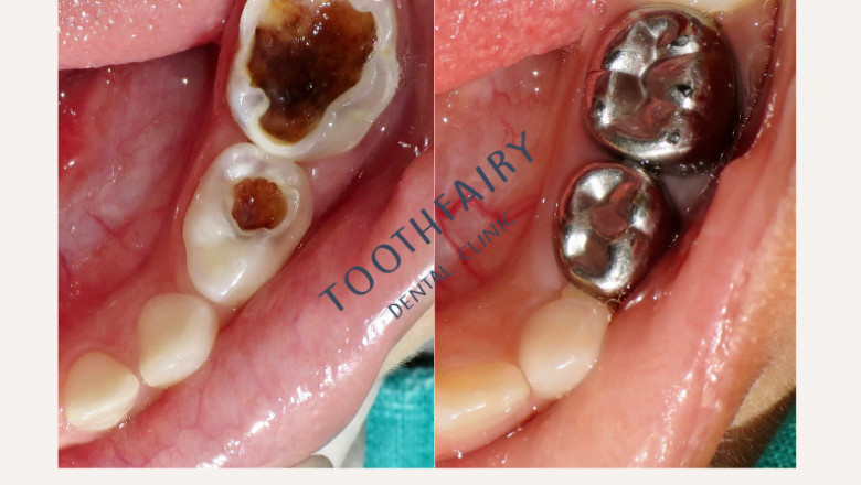 Getting the top Dental Clinic: Essential Issues to consider