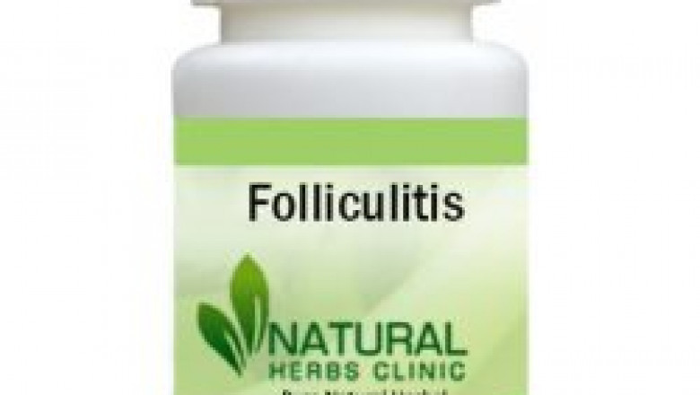 Herbal Treatment for Folliculitis | Natural Remedies | Natural Herbs Clinic