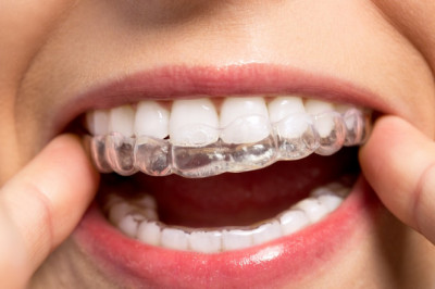 Why Do Dentists Suggest Wearing Mouthguards For Teeth?