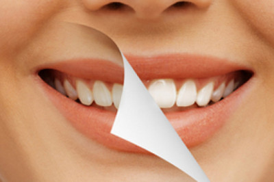 Different Types of Cosmetic Dental Procedures - Tower House Dental Clinic