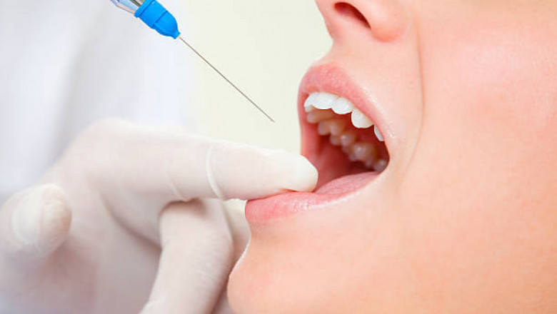 Dental anesthesia Market Scenario, Global Analysis By International Prestigious Players, Industry Demand and Trends by Forecast 2027