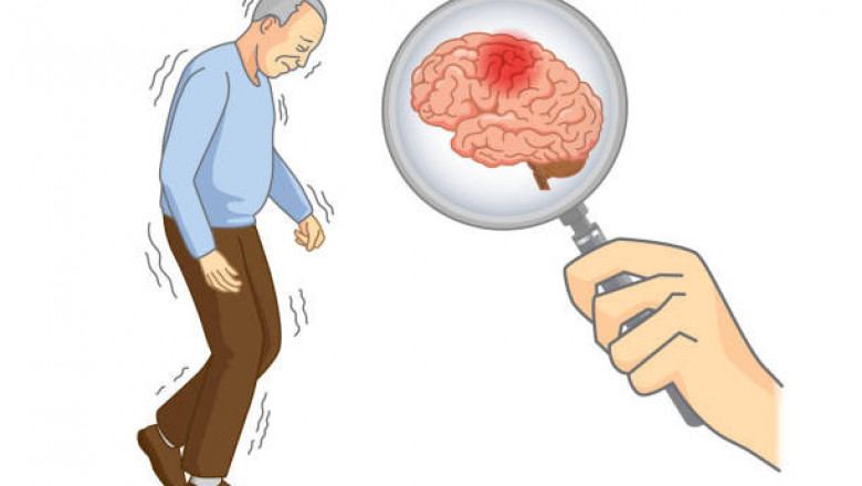 Parkinson's Disease Therapeutics Market Recent Opportunities, Growth Size, Regional Analysis and Forecasts to 2027