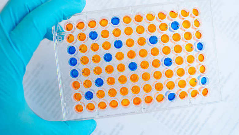 Immunoassay Analyzers Market Detailed Opportunities, Growth Drivers, Trends, and Challenges Impacting By 2027