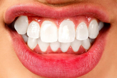 What Is Teeth Grinding?