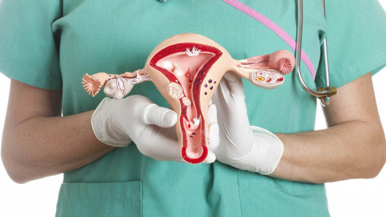 Global Cervical Dysplasia Market: Share, Size, Growth, Opportunities, And Forecasts, 2020-2027