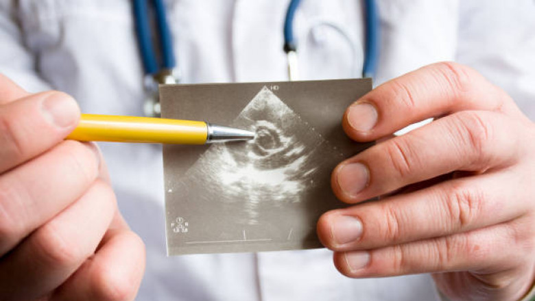 Mitral Valve Stenosis Market: Growth, Opportunities, Key Players &amp; Forecast Outlook 2027