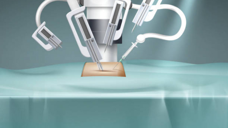 Robot-Assisted Surgical Systems Market COVID-19 Research Analysis, Strategic Insights and Forecast to 2027