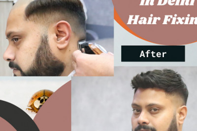 The best hair loss treatment for men- Delhi Hair Fixing