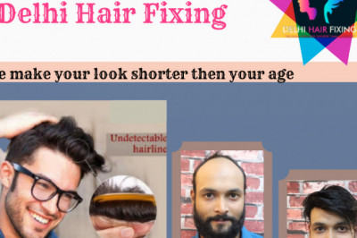 The best hair loss treatments for men