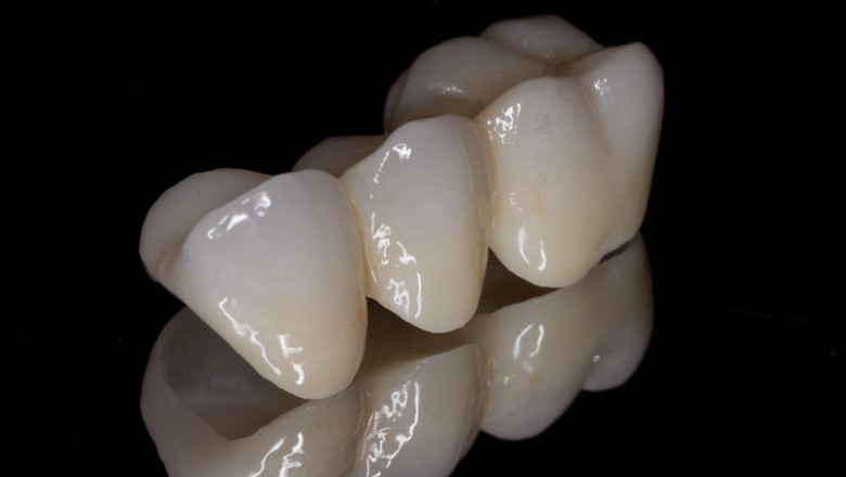 Zirconia Based Dental Materials Are The Second-Most Biocompatible After Gold In Terms Of Raw Materials