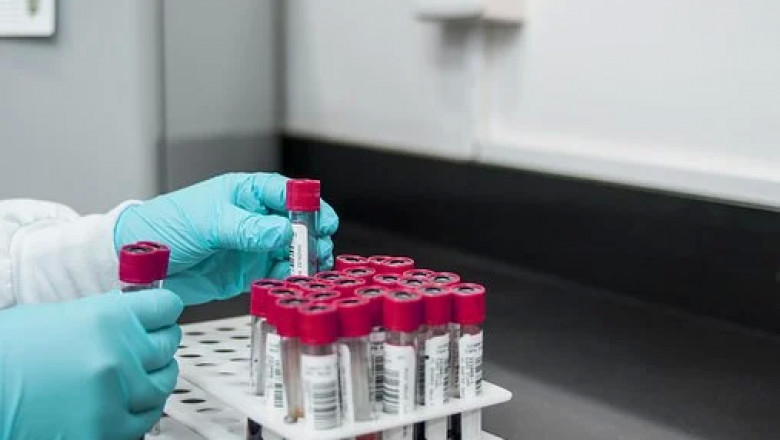 Automated Cell Culture Market Outlook, Deployment Type and Business Opportunities 2027